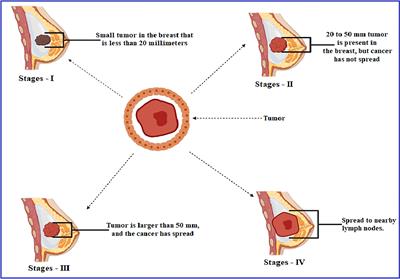 Development of new bioactive molecules to treat breast and lung cancer with natural myricetin and its derivatives: A computational and SAR approach